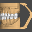 2.png Dental Model (in articulator)