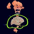 screenshot144.jpg Central nervous system cortex limbic basal ganglia stem cerebel 3D model