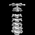 vertebra-5.jpg Archivo STL El modelo de la columna cervical C1-C7 con una parte del cráneo・Modelo para descargar y imprimir en 3D
