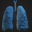 HLC_Render7.png Human Lung Cancer