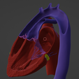8.png 3D Model of Heart with Transposition of the Great Arteries, long axis view
