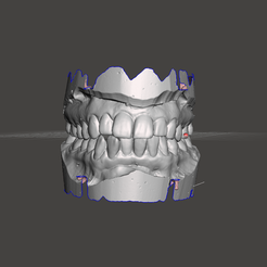 scrnn.png Orthodontics dental model