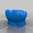 9da1d2c9f9a5abf065eaa324ee455c6b.png dental partial dentures