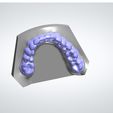 Clipboard-2024-02-25-15-31-20.jpg DIGITAL BLEACHING TRAYS - 4 STL FILES (UPPER AND LOWER TRAY) + 3D MODELS !!!