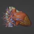 3.png 3D Model of Human Heart with Pulmonary Artery Sling (PAS) - generated from real patient