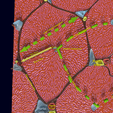 Screenshot-30.png Liver histology anatomy labelled