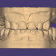 VESTIBULAR-ORIGINAL.png ENCERADO / MOCK-UP #2