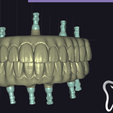 Screenshot-2024-11-17-012617.png All Collection For exocad