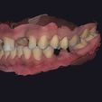 44.jpg Set of dental models for study