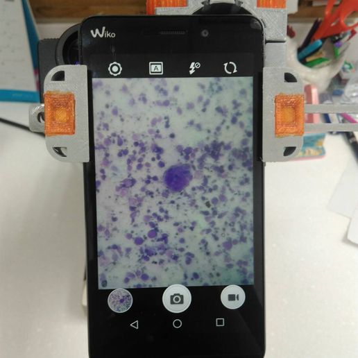 1473773080201.jpg Universal Smart Phone Microscope Mount Remix