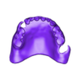 789513050_20250210_1316_Tech_01__-_oprava_A3,5_H_flex_0.stl DIGITAL FLEXIBLE UPPER PARTIAL DENTURE (3D models !!!) - 7 stl files for download)