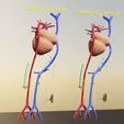 ps-0042.jpg PDA Patent Ductus Arteriosus vs Normal blood circulation