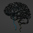26.png 3D Model of Brain and Aneurysm