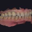 11.jpg Set of dental models for study