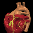 10.png 3D Model of Transposition of the Great Arteries Open Duct