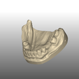 PEI4.PNG Dental impression trays lower + lowerjaw model
