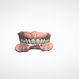 Snímka-obrazovky-2024-04-06-122940.png TOTAL and PARTIAL REMOVABLE DENTURES