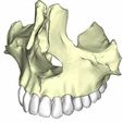 19.jpg maxilar con dientes