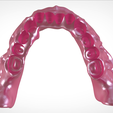 Screenshot_9.png Digital Full Dentures for Gluedin Teeth with Manual Reduction