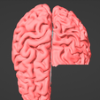 5.png 3D Model of Brain - section
