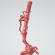 p4.png Case 1 to 6: 3D aortic and iliac artery aneurysm