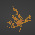 w10.png 3D Model of Middle Cerebral Artery (MCA) Aneurysm