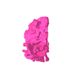 1.png White matter of right temporal lobe SEGMENTED