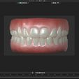 09_UI_BLENDER.jpg Human teeth with gums