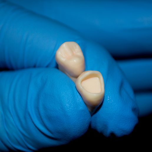 3.jpg maxillary first premolar \\ occlusal restoration model