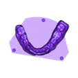 789513050_20240808_0848_Tech_01_K_bruxi_UnsectionedModel_LowerJaw.stl DIGITAL BRUXISM TRAY/SPLINT - 3 stl files (tray+model+antagonist)