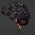 36.png 3D Model of Brain and Aneurysm