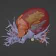 6.png 3D Model of Human Heart with Aortic Arch Hypoplasia (AAH) - generated from real patient