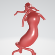Pararenal-aortic-aneurysm.png Case 1 to 6: 3D aortic and iliac artery aneurysm