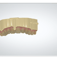 Screenshot_4.png Digital Dental Unsectioned Study Model