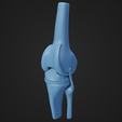 KneeReplacement_2.png Peças de substituição do joelho