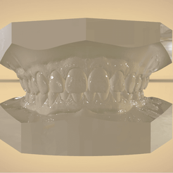 Screenshot_14.png STL file Digital Orthodontic Study Models with Virtual Bases・3D printing idea to download, LabMagic3D