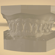 Screenshot_30.png Digital Orthodontic Study Models with Virtual Bases