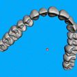 02.jpg Teeth for temporary crowns - maxillary-teeth