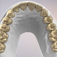 29.jpg 3D Dental Jaws Replica with Detachable Teeth