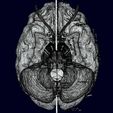 screenshot161.jpg Central nervous system cortex limbic basal ganglia stem cerebel 3D model