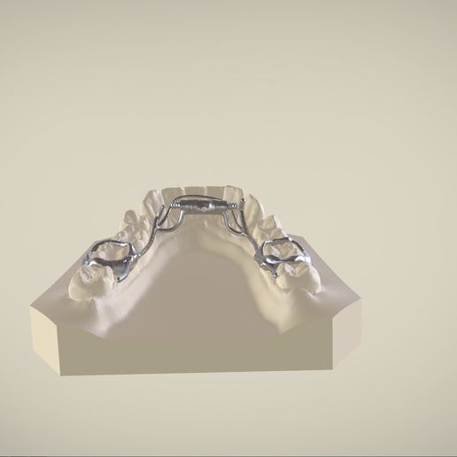 Snapshot_2017-3-1_13-13-14.jpg Digital Dr. Williams's Ortho Appliance