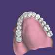 Capture4.png Upper and lower full dentures. Teeth and bases