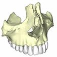 18.jpg maxilar con dientes