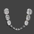 meshmixer_H1in9S5x0y.png Pediatric Teeth Shells