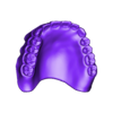 789513050_20230927_1549_Tech_01_1_Monoblock_Print.stl DIGITAL TOTAL REMOVABLE DENTURES - 6 stl files (upper jaw, lower jaw, artificial teeth for upper and lower jaw, 2x monoblock)