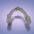 Armature.png Dental partial framework metal
