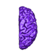 brain 6-_new_r_cortex_mat1.stl 3D Model of Brain and Aneurysm