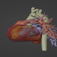 2.png 3D Model of Healthy Human Heart - generated from real patient