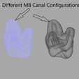 Different MB Canal Configurations Root Canal Teeth for Practice 10 models