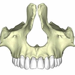 17.jpg maxilla with teeths
